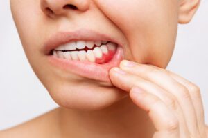 dentist Middleton gum disease