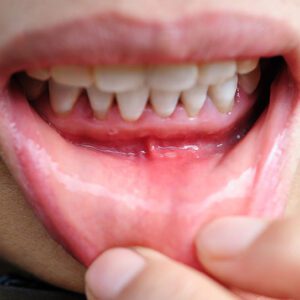 Dental Arts on Essex - Dental Blog Dental Arts on Essex -